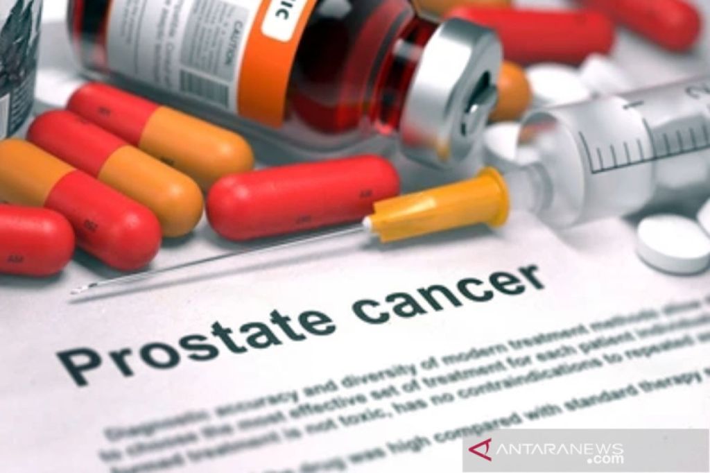 BRIN-UGM riset senyawa brazilin, terapi kanker&nbsp;prostat